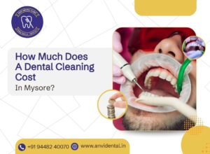 dental cleaning cost in mysore
