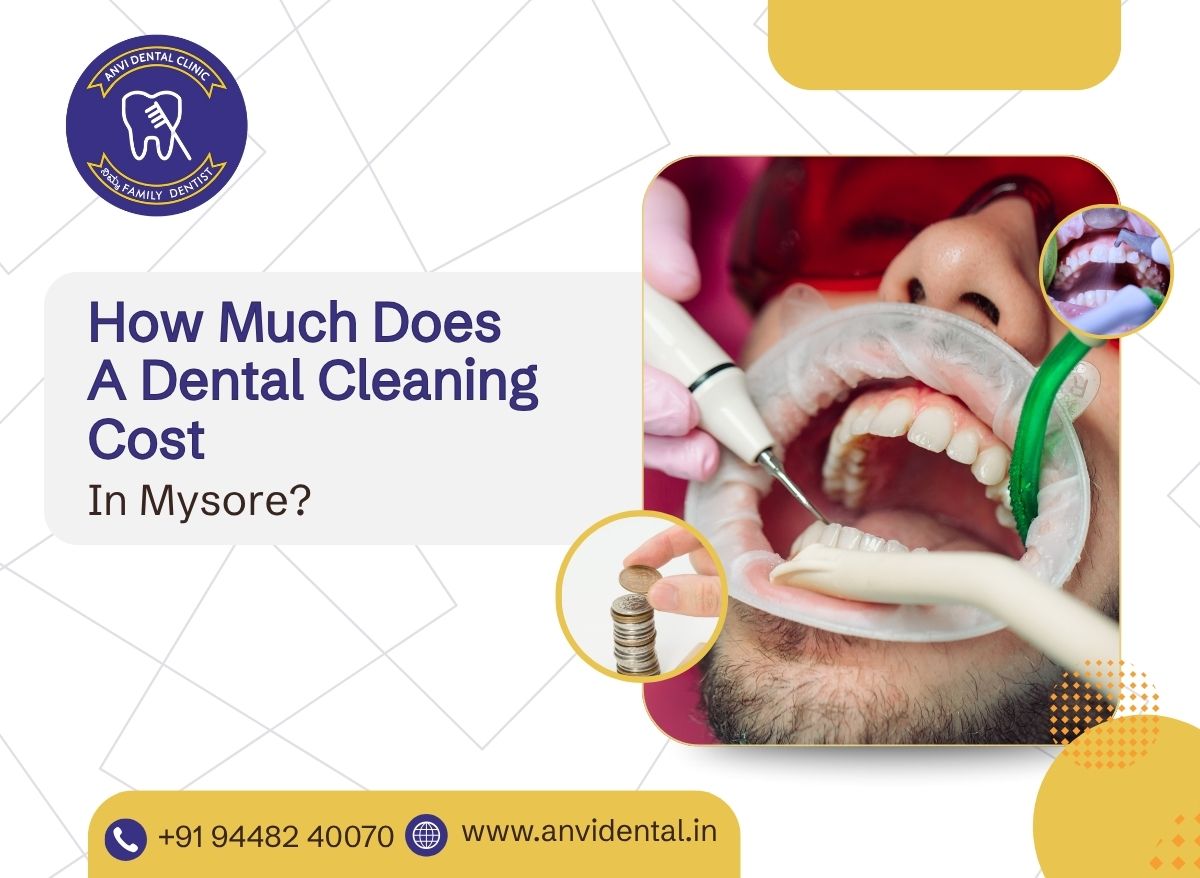 dental cleaning cost in mysore