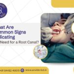 common signs indicating the need for a root canal