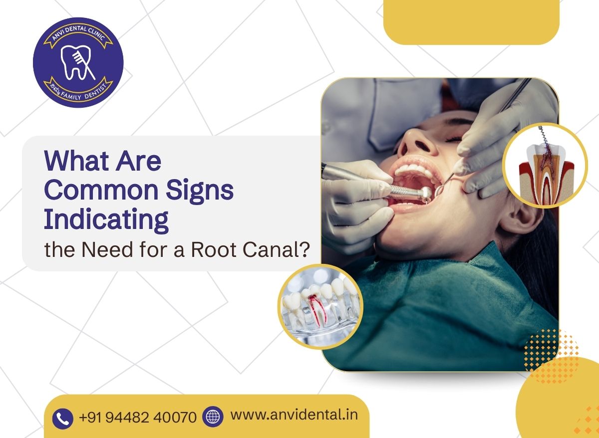 common signs indicating the need for a root canal