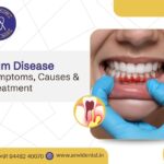 gum disease symptoms causes treatment