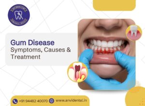 gum disease symptoms causes treatment