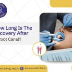 how long is the recovery after a root canal