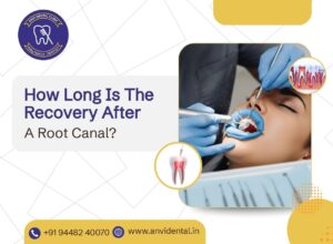 how long is the recovery after a root canal