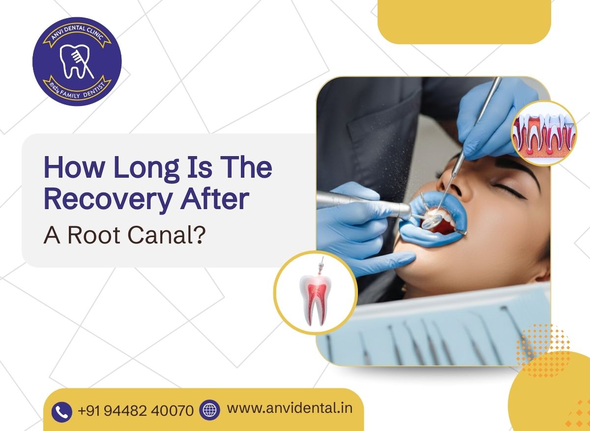 how long is the recovery after a root canal