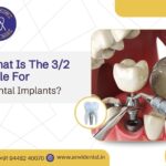 what is the 3/2 rule for dental implants