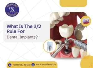 what is the 3/2 rule for dental implants