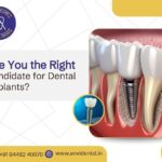 right candidate for dental implants