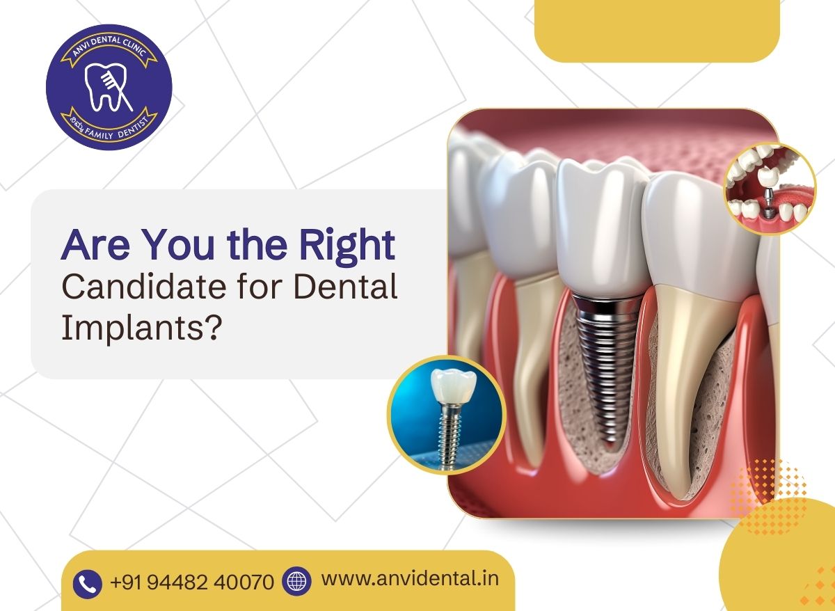 right candidate for dental implants